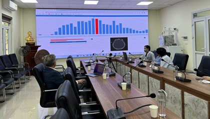 Hiển thị chi tiết tin tức ONENET phối hợp với chuyên gia Đức ứng dụng AI tại Bệnh viện Hữu nghị Việt Đức Hình ảnh tin tức ONENET phối hợp với chuyên gia Đức ứng dụng AI tại Bệnh viện Hữu nghị Việt Đức